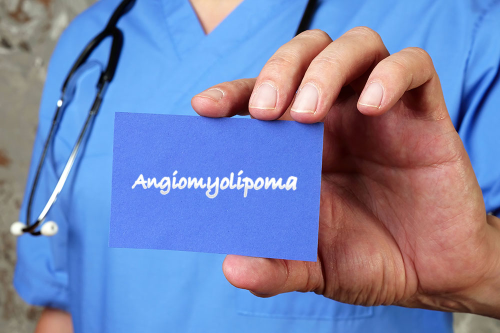 Angiomyolipoma &#8211; Symptoms, risk factors, and management