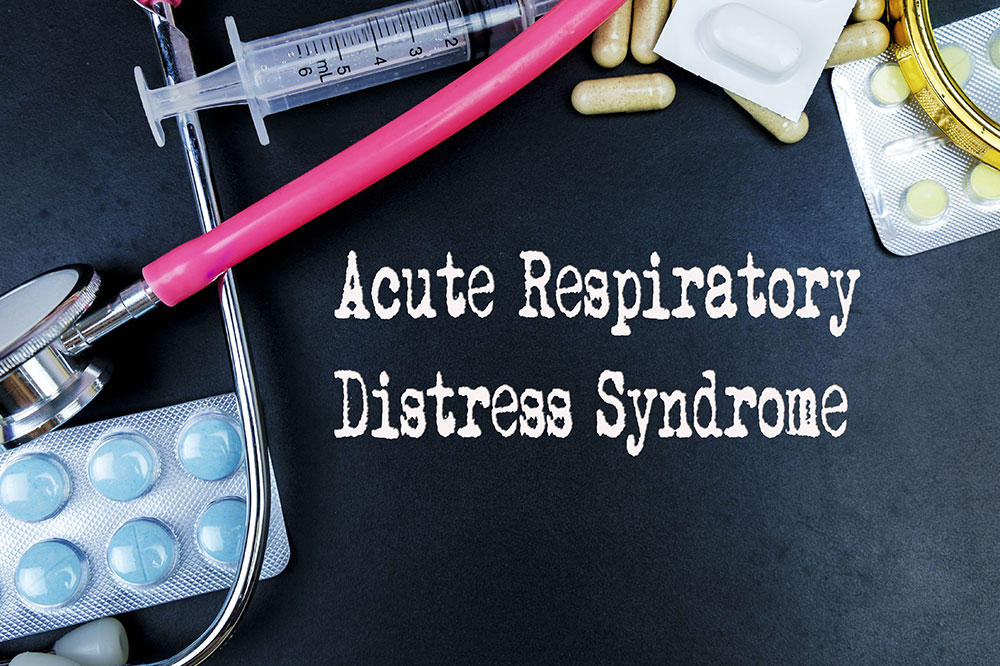 ARDS &#8211; Symptoms, causes, and management options