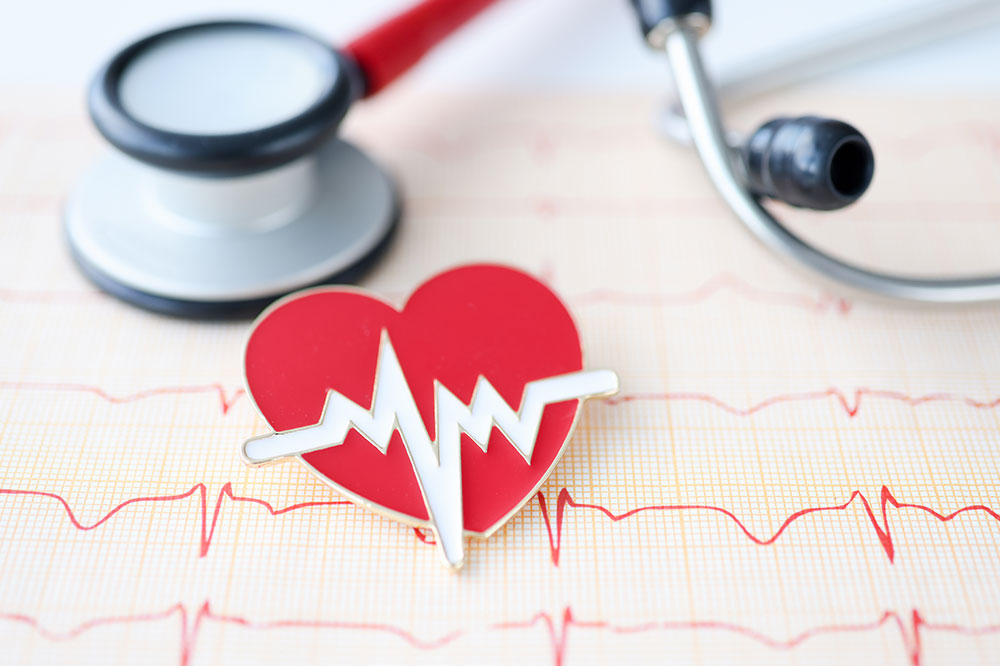 Arrhythmias and the benefits of ablation therapy