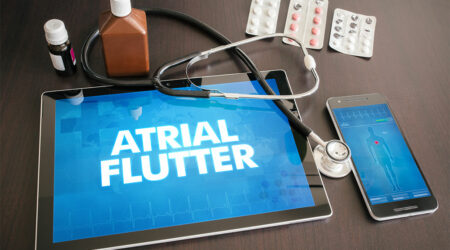 Atrial flutter &#8211; Its signs, causes, and management options