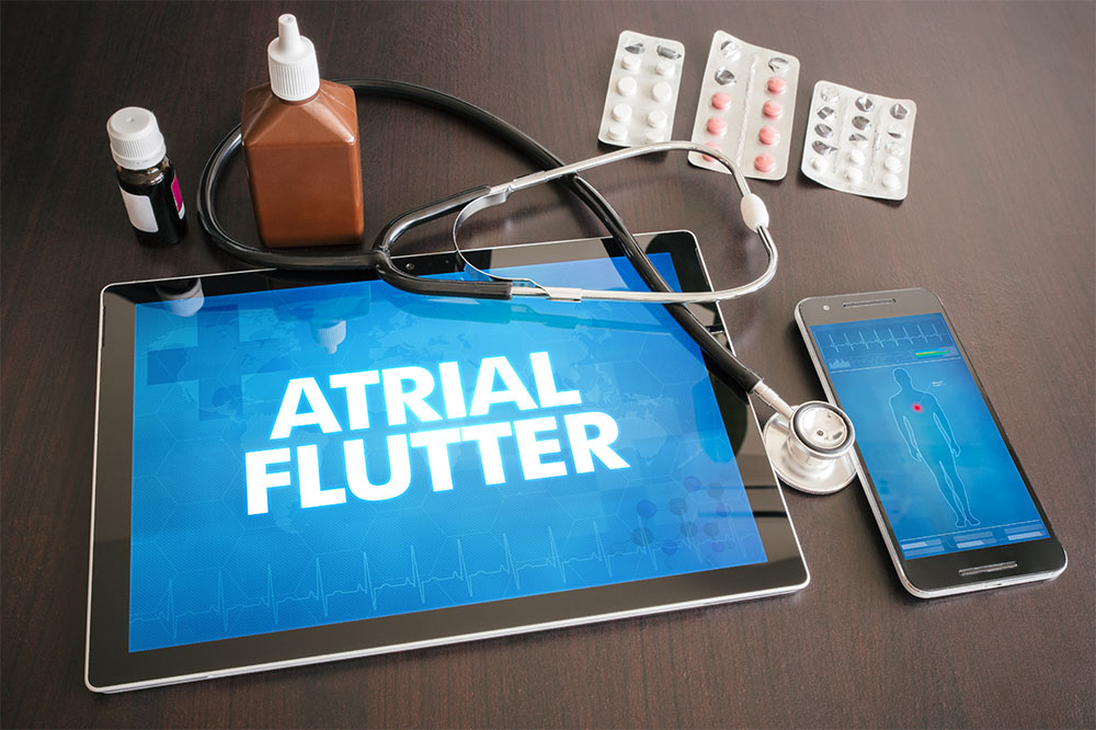 Atrial flutter &#8211; Its signs, causes, and management options