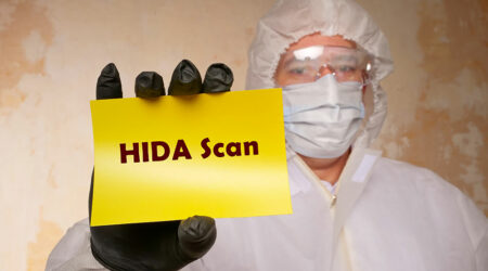 HIDA scan &#8211; Procedure, scan results, and costs