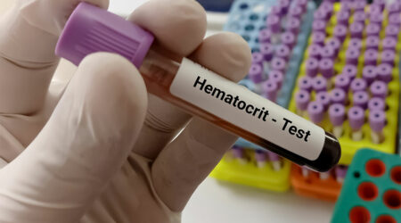 Key things to know about a hematocrit test