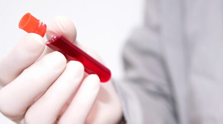 Learn about the various aspects of blood cancer