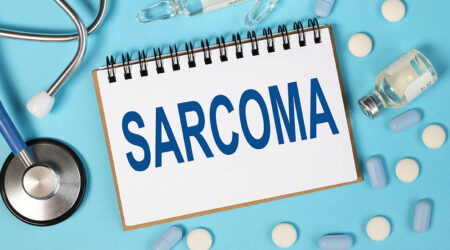 Synovial sarcoma &#8211; Symptoms, causes, and management