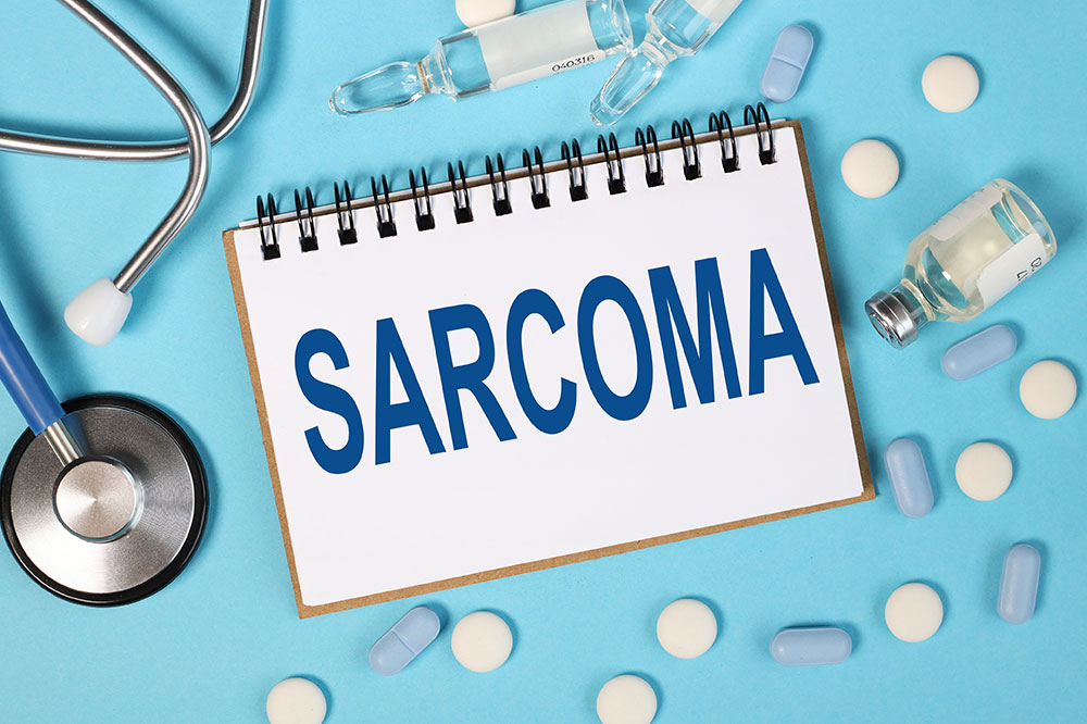 Synovial sarcoma &#8211; Symptoms, causes, and management