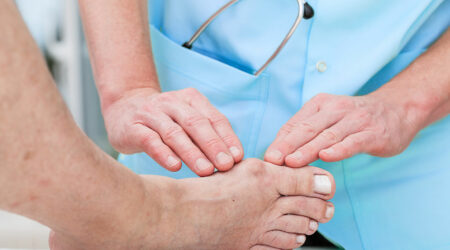 Bunion surgery &#8211; Types, recovery, cost, and care tips