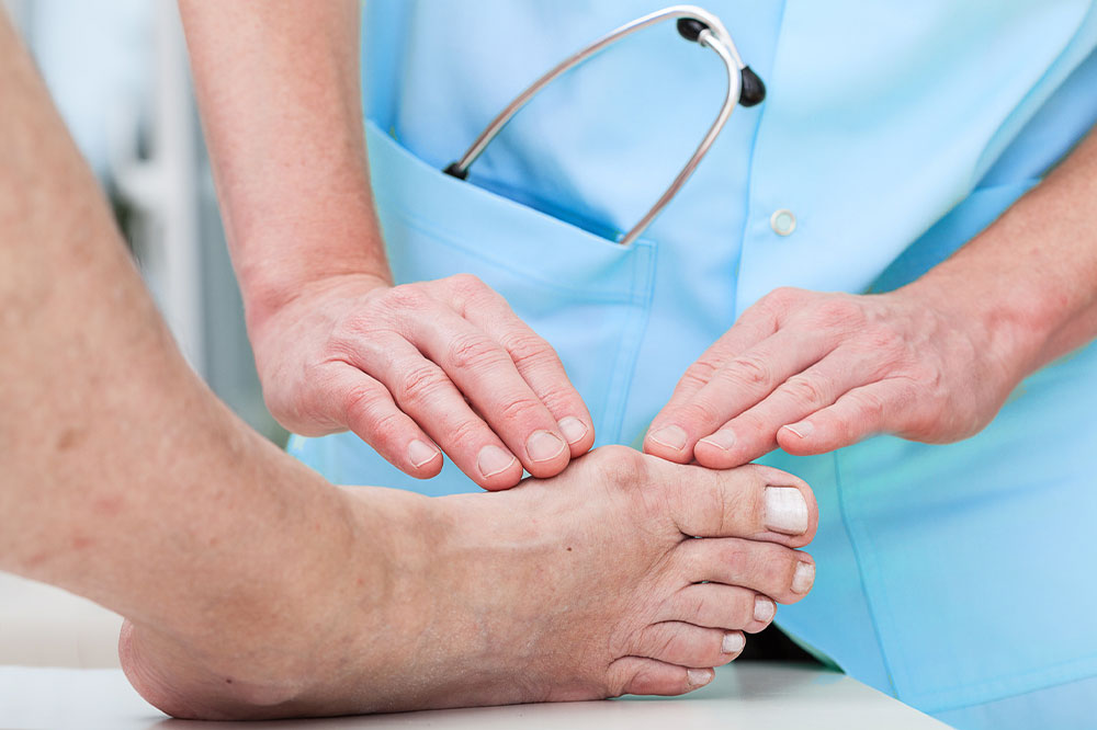 Bunion surgery &#8211; Types, recovery, cost, and care tips