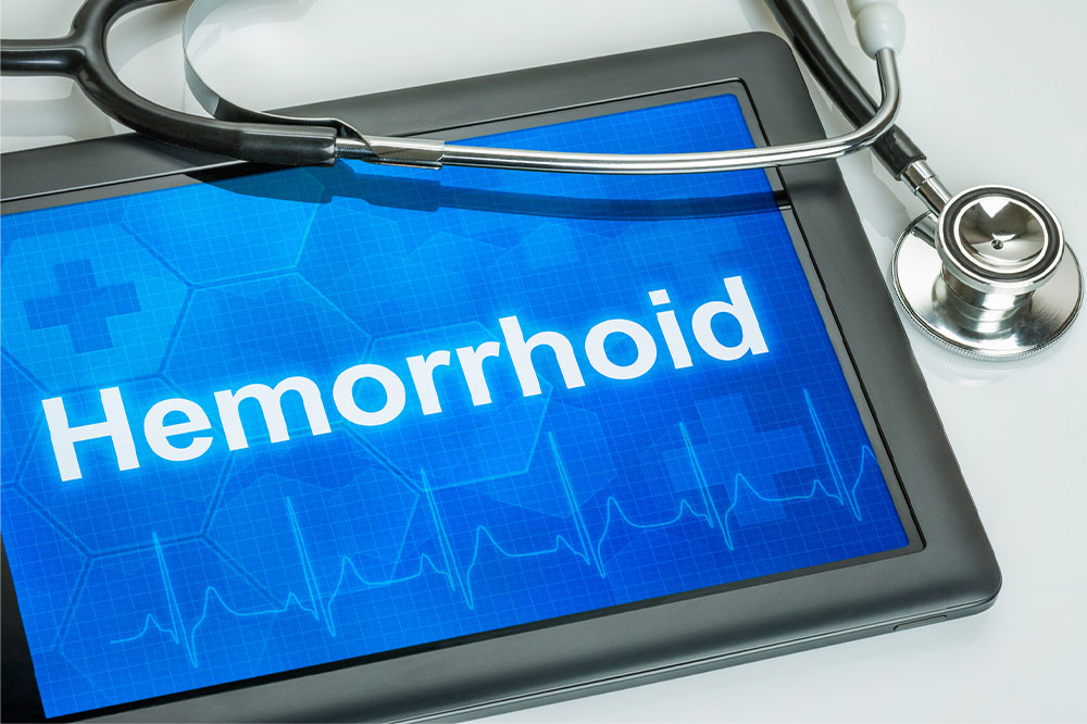 Causes, symptoms, and management of hemorrhoids