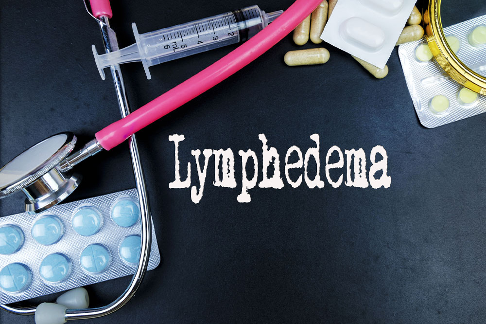 Known causes, signs, and management of lymphedema explained