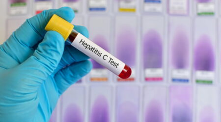 Top 5 warning signs to look out for in Hepatitis C