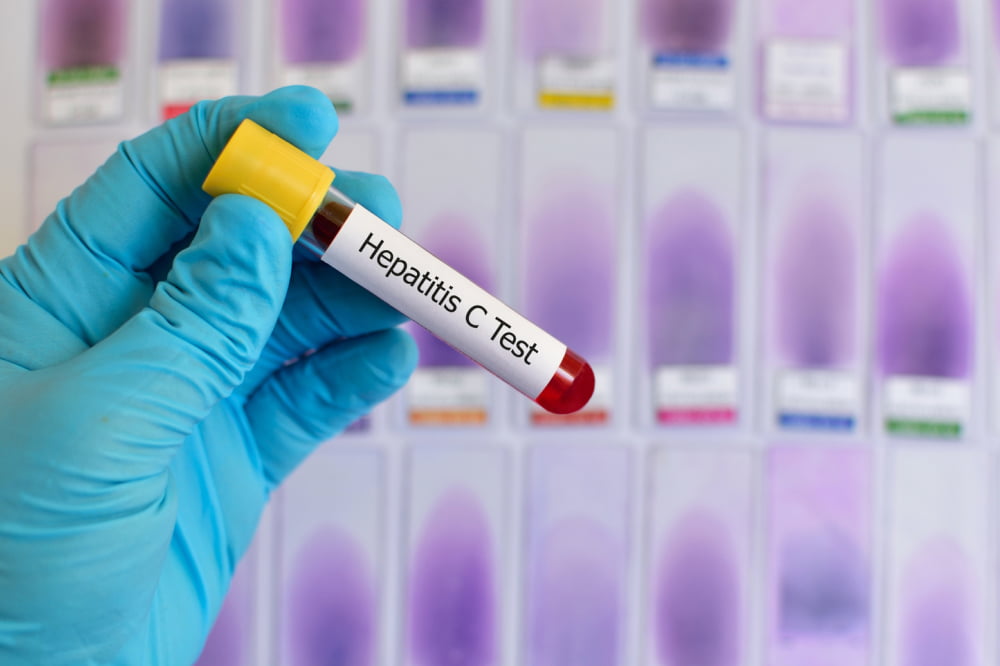 Top 5 warning signs to look out for in Hepatitis C